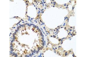 Immunohistochemistry of paraffin-embedded Rat lung using LRG1 Polyclonal Antibody at dilution of 1:100 (40x lens). (LRG1 antibody)