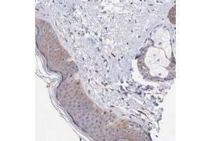 Immunohistochemical staining of human skin with PPFIBP1 polyclonal antibody  shows moderate cytoplasmic positivity in epidermal cells and adnexal cells at 1:200-1:500 dilution.