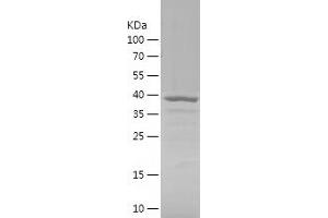 Western Blotting (WB) image for GIPC PDZ Domain Containing Family, Member 2 (GIPC2) (AA 1-315) protein (His tag) (ABIN7123087) (GIPC2 Protein (AA 1-315) (His tag))