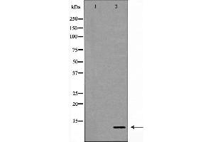 Western blot analysis of lovo cell lysate, using S100A11 Antibody. (S100A11 antibody  (Internal Region))