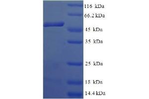 SDS-PAGE (SDS) image for Cytokine Induced Apoptosis Inhibitor 1 (CIAPIN1) (AA 1-312), (full length) protein (His-SUMO Tag) (ABIN5711429) (CIAPIN1 Protein (AA 1-312, full length) (His-SUMO Tag))
