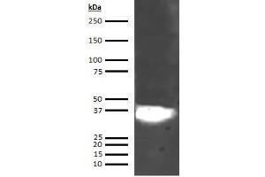 Western Blotting (WB) image for anti-Annexin A5 (ANXA5) (AA 1-320) antibody (ABIN5564834) (Annexin V antibody  (AA 1-320))