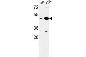 Western Blotting (WB) image for anti-Nucleoporin Like 2 (NUPL2) antibody (ABIN3004233)