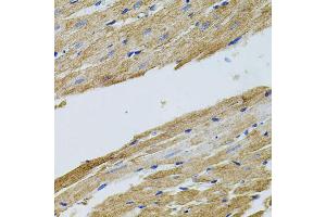 Immunohistochemistry of paraffin-embedded rat heart using TRMT2A antibody (ABIN5973559) at dilution of 1/100 (40x lens). (TRMT2A antibody)
