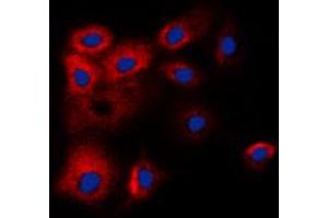 Immunofluorescent analysis of BCLW staining in HL60 cells. (BCL2L2 antibody  (C-Term))
