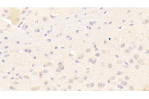 Detection of KEL in Mouse Cerebrum Tissue using Polyclonal Antibody to Kell Protein (KEL) (KEL antibody  (AA 49-358))