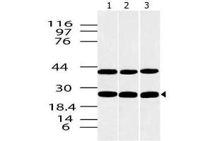 Image no. 1 for anti-C-Type Lectin Domain Family 4, Member E (CLEC4E) antibody (ABIN5027699)