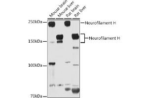 Western blot analysis of extracts of various cell lines, using Neurofilament H antibody (ABIN6129638, ABIN6144512, ABIN6144513 and ABIN6224502) at 1:1000 dilution.
