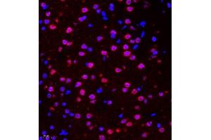 Immunofluorescence of paraffin embedded mouse brain using HES3 (ABIN7074159) at dilution of 1:2000 (400x lens) (HES3 antibody)