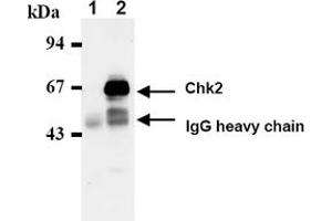 Western Blotting (WB) image for anti-Checkpoint Kinase 2 (CHEK2) antibody (ABIN487488) (CHEK2 antibody)