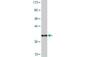 Western Blot detection against Immunogen (36. (SLC20A2 antibody  (AA 243-342))