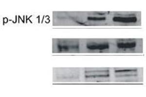 Image kindly provided by Dr. (JNK antibody  (pThr183, pTyr185))