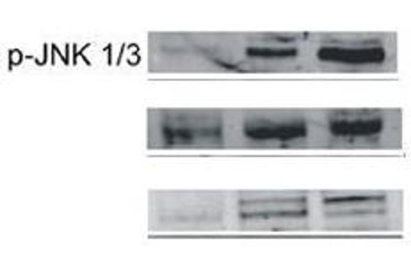 JNK anticorps  (pThr183, pTyr185)