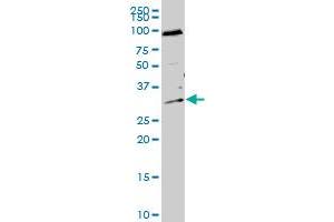 HTATIP2 polyclonal antibody (A01), Lot # 050921JC01. (HIV-1 Tat Interactive Protein 2, 30kDa (HTATIP2) (AA 1-242) antibody)