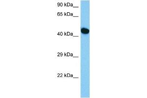Host:  Mouse  Target Name:  HNF1B  Sample Tissue:  Mouse Skeletal Muscle  Antibody Dilution:  1ug/ml (HNF1B antibody  (C-Term))