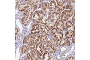 Immunohistochemical staining of human kidney with MFSD7 polyclonal antibody  shows strong cytoplasmic positivity in tubular cells at 1:50-1:200 dilution. (MFSD7 antibody)