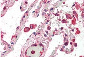 Human Lung (formalin-fixed, paraffin-embedded) stained with CENTB2 antibody ABIN337012 at 5 ug/ml followed by biotinylated anti-goat IgG secondary antibody ABIN481715, alkaline phosphatase-streptavidin and chromogen. (Centaurin beta 2 antibody  (AA 766-778))