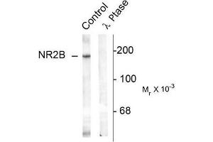 Image no. 1 for anti-Glutamate Receptor, Ionotropic, N-Methyl D-Aspartate 2B (GRIN2B) (pTyr1336) antibody (ABIN372686) (GRIN2B antibody  (pTyr1336))