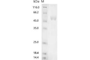 (Tris-Glycine gel) Discontinuous SDS-PAGE (reduced) with 5 % enrichment gel and 15 % separation gel.