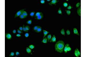 Immunofluorescent analysis of PC-3 cells using ABIN7163671 at dilution of 1:100 and Alexa Fluor 488-congugated AffiniPure Goat Anti-Rabbit IgG(H+L) (PHLDA3 antibody  (AA 43-95))