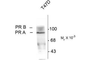 Western Blotting (WB) image for anti-Progesterone Receptor (PGR) (pSer190) antibody (ABIN371834)