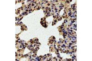Immunohistochemistry (IHC) image for anti-Ran GTPase Activating Protein 1 (RANGAP1) antibody (ABIN7308258) (RANGAP1 antibody)