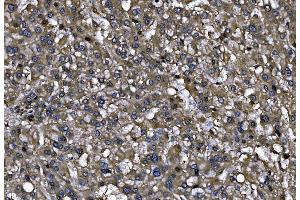 IHC analysis of ENAH/MENA using anti-ENAH/MENA antibody (ABIN7601316). (ENAH antibody  (AA 32-551))