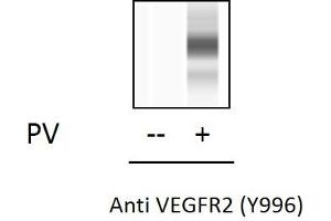 HUVEC cells were untreated or treated with PV. (VEGFR2/CD309 ELISA Kit)