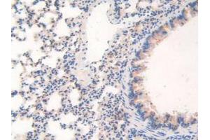 IHC-P analysis of Mouse Lung Tissue, with DAB staining. (WARS antibody  (AA 29-195))