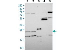 Western blot analysis of Lane 1: RT-4, Lane 2: U-251 MG, Lane 3: Human Plasma, Lane 4: Liver, Lane 5: Tonsil with NUDT16L1 polyclonal antibody  at 1:250-1:500 dilution. (NUDT16L1 antibody)