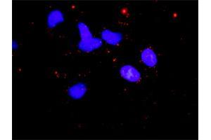 Proximity Ligation Analysis of protein-protein interactions between STK11 and CAB39. (CAB39 antibody  (AA 1-341))