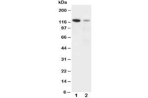 Western blot testing of Integrin alpha 3 antibody and Lane 1:  rat heart;  2: HeLa cell lysate. (ITGA3 antibody  (N-Term))