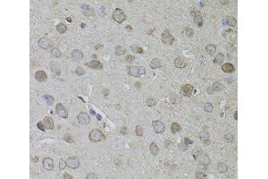 Immunohistochemistry of paraffin-embedded Mouse brain using CKAP4 Polyclonal Antibody (CKAP4 antibody)