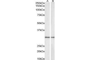ABIN2564214 (1µg/ml) staining of Rat (A) and Pig (B) Kidney lysate (35µg protein in RIPA buffer). (NQO1 antibody  (C-Term))
