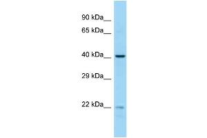 Host:  Rabbit  Target Name:  EME2  Sample Type:  MCF7 Whole cell lysates  Antibody Dilution:  1. (EME2 antibody  (Middle Region))