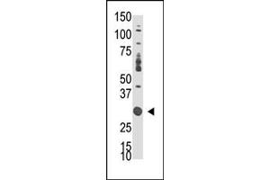 Western Blotting (WB) image for anti-Docking Protein 5 (DOK5) (C-Term) antibody (ABIN359963) (DOK5 antibody  (C-Term))