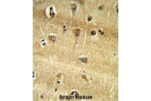 Immunohistochemistry (IHC) image for anti-Ribosomal Protein S9 (RPS9) antibody (ABIN3002715) (RPS9 antibody)