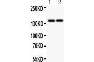 Anti-Collagen III Picoband antibody,  All lanes: Anti Collagen III at 0. (COL3A1 antibody  (C-Term))