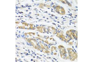 Immunohistochemistry of paraffin-embedded human stomach using IL11 antibody (ABIN5975342) at dilution of 1/100 (40x lens). (IL-11 antibody)