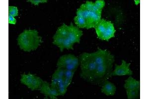 Immunofluorescence staining of MCF-7 cells with ABIN7175232 at 1:50, counter-stained with DAPI. (ATP6V1C1 antibody  (AA 129-382))