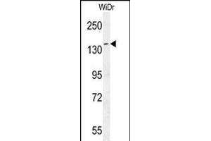 DM1- Antibody (N-term) (ABIN651631 and ABIN2840337) western blot analysis in WiDr cell line lysates (35 μg/lane).
