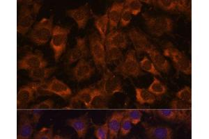 Immunofluorescence analysis of C6 cells using SEC23B Polyclonal Antibody at dilution of 1:100. (Sec23 Homolog B antibody)