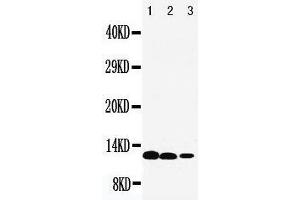 Anti-IL13 antibody, Western blotting Lane 1: Recombinant Human IL13 Protein 10ng Lane 2: Recombinant Human IL13 Protein 5ng Lane 3: Recombinant Human IL13 Protein 2.