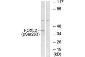 Western blot analysis of extracts from K562 cells treated with Na3VO4 0. (FOXL2 antibody  (pSer263))