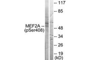 Western blot analysis of extracts from HeLa cells treated with PMA 125ng/ml 30', using MEF2A (Phospho-Ser408) Antibody. (MEF2A antibody  (pSer408))