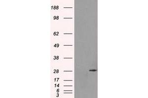 Image no. 2 for anti-Replication Protein A2, 32kDa (RPA2) antibody (ABIN1500735) (RPA2 antibody)