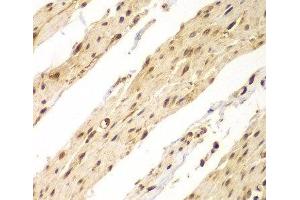 Immunohistochemistry of paraffin-embedded Human colon using CDX1 Polyclonal Antibody at dilution of 1:100 (40x lens). (CDX1 antibody)