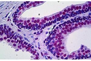 Human Prostate: Formalin-Fixed, Paraffin-Embedded (FFPE) (PRKDC antibody  (AA 4019-4129))