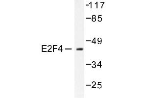 Image no. 1 for anti-E2F4/E2F5 (E2F4/5) antibody (ABIN265389) (E2F4/E2F5 (E2F4/5) antibody)