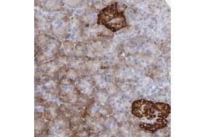Immunohistochemical staining of human pancreas with LHFPL1 polyclonal antibody  shows strong cytoplasmic positivity in islet cells at 1:50-1:200 dilution. (LHFPL1 antibody)